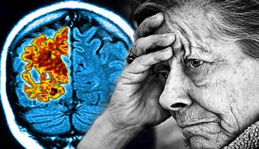Akdeniz tipi diyet Alzheimer'a kalkan