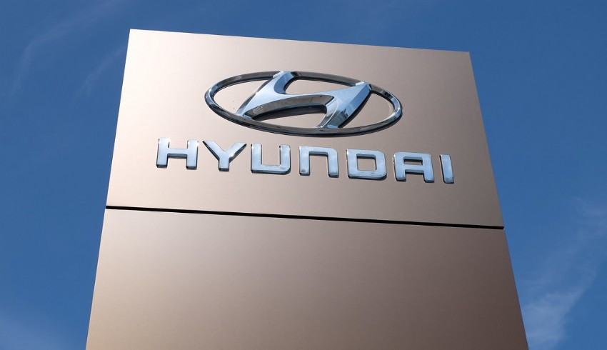Hyundai den manuel düğme tercihi