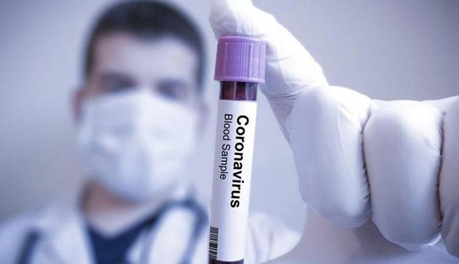 Almanya koronavirüs salgınını 8 yıl önce öngörmüş: Kontrolü AIDS den zor olacak 
